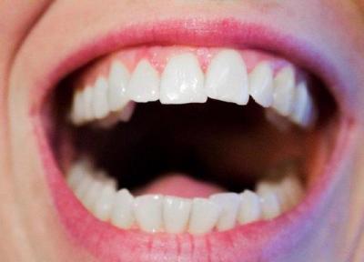 5 درمان خانگی برای پوسیدگی دندان
