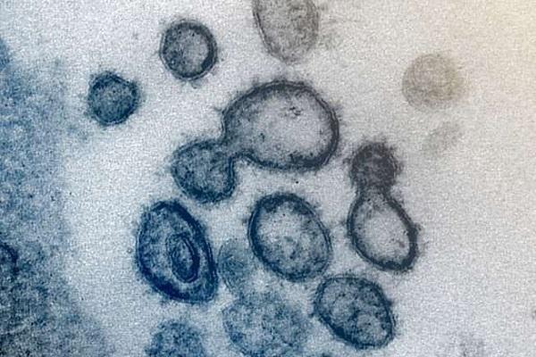 درمان ویروس کرونا با آنتی بادی تصویب شد