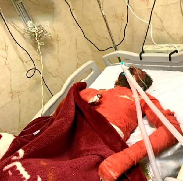 فرزند شهید یاسوجی که خودسوزی نموده بود درگذشت