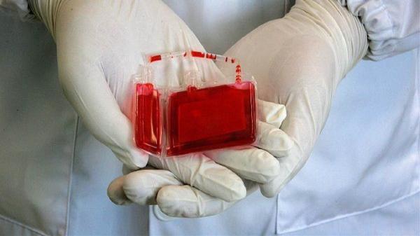 ذخیره سازی 2 هزار نمونه خون بند ناف در استان قزوین